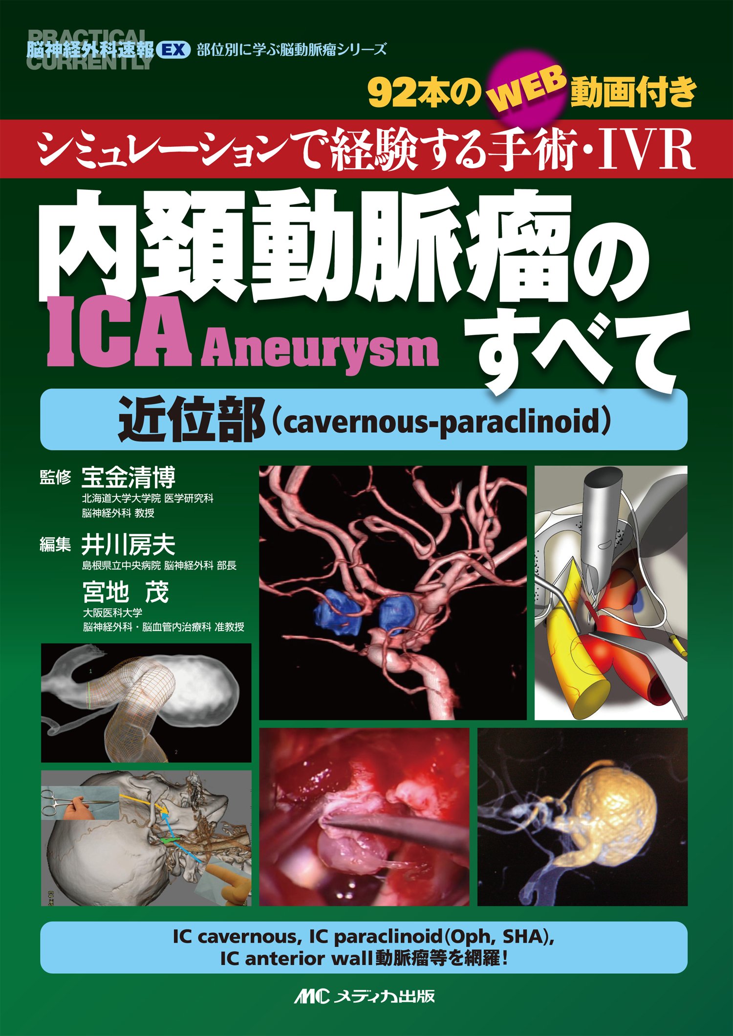 内頚動脈瘤 Ica Aneurysm のすべて 近位部 Cavernous Paraclinoid シミュレーションで経験する手術 Ivr 92本のweb動画付き 脳神経外科速報ex部位別に学ぶ脳動脈瘤シリーズ 宝金 清博 井川 房夫 宮地 茂 本 通販 Amazon
