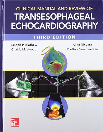 Download Clinical Manual and Review of Transesophageal Echocardiography PDF