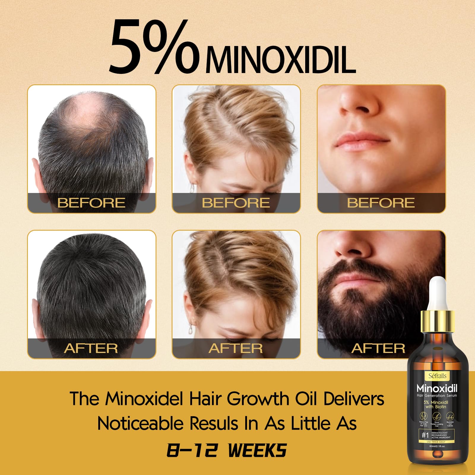 5% Minoxidil Hair Growth Serum Oil For Men and Women, Biotin Hair Serum, Safest Hair Regrowth Treatment, Prevent Scalp Hair Loss 60ml / 2.11 fl.oz