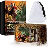 African Black Soap, 100% Pure Natural Bar Soap for Troubled Skin Cleanser, Aids Against Dark Spots, Dry Skin, Combat Acne & Signs of Aging, Great For Pimples, Blackhead, Face & Body Wash 100g.