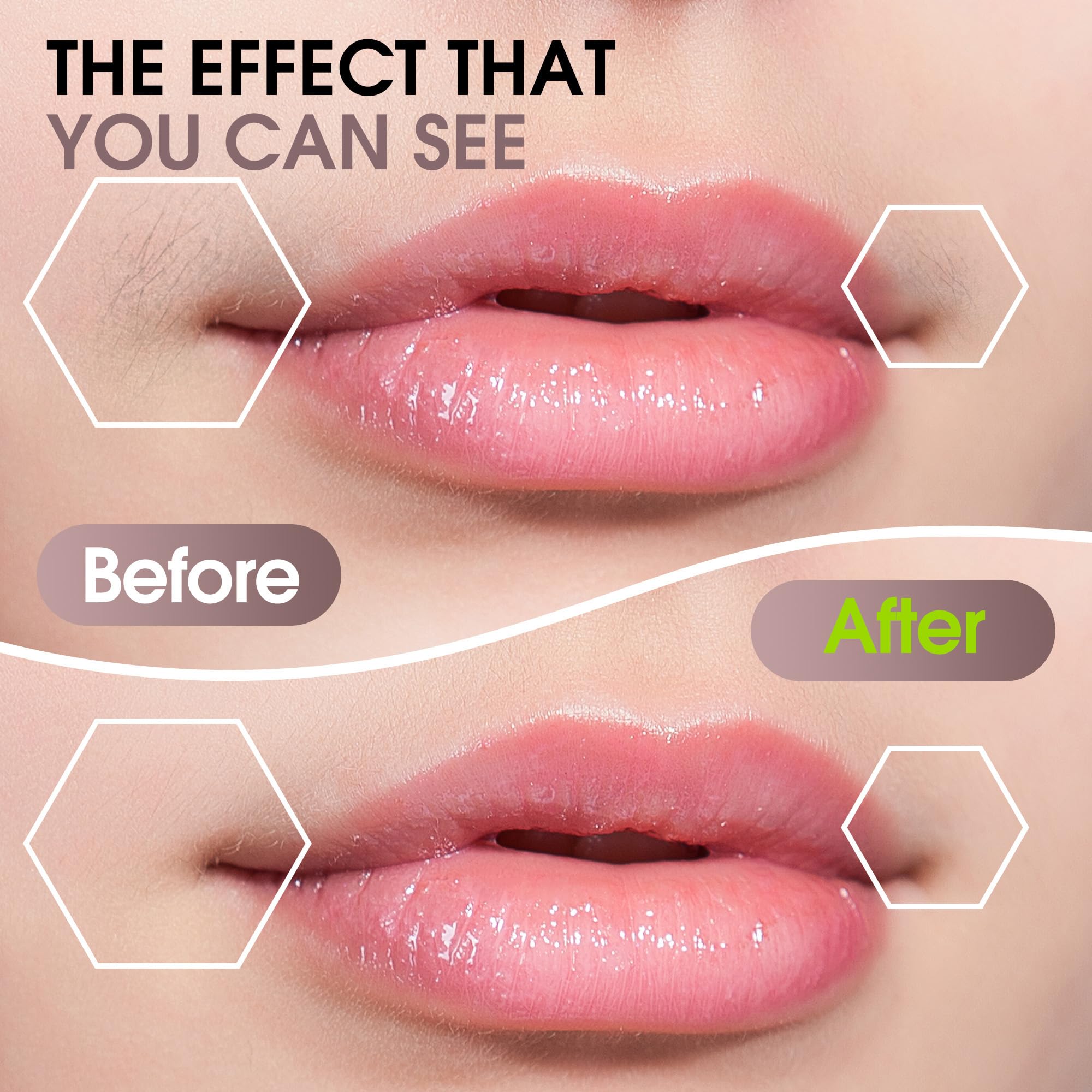 Facial Hair Removal for Women: Electric Hair Removal Device - Rechargeable Painless Face Razor for Chin Upper Lip Peach Fuzz with Light Gifts for Women(Rose Gold)