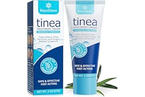 Roycederm Tinea Versicolor Treatment, Athletes Foot Treatment, Ringworm Treatment for Humans, for Tinea Versicolor & Pedis,Fast Healing Anti Fungal Skin Cream - Multi-Functional