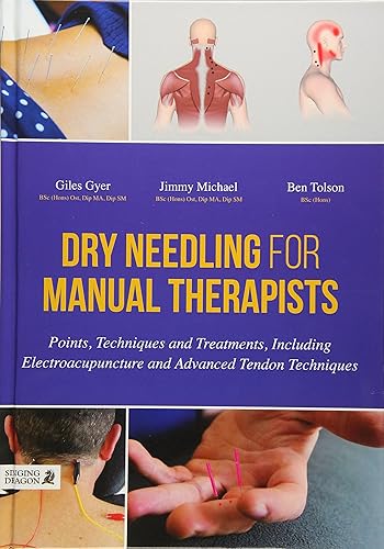 Download Dry Needling for Manual Therapists: Points, Techniques and Treatments, Including Electroacupuncture and Advanced Techniques PDF