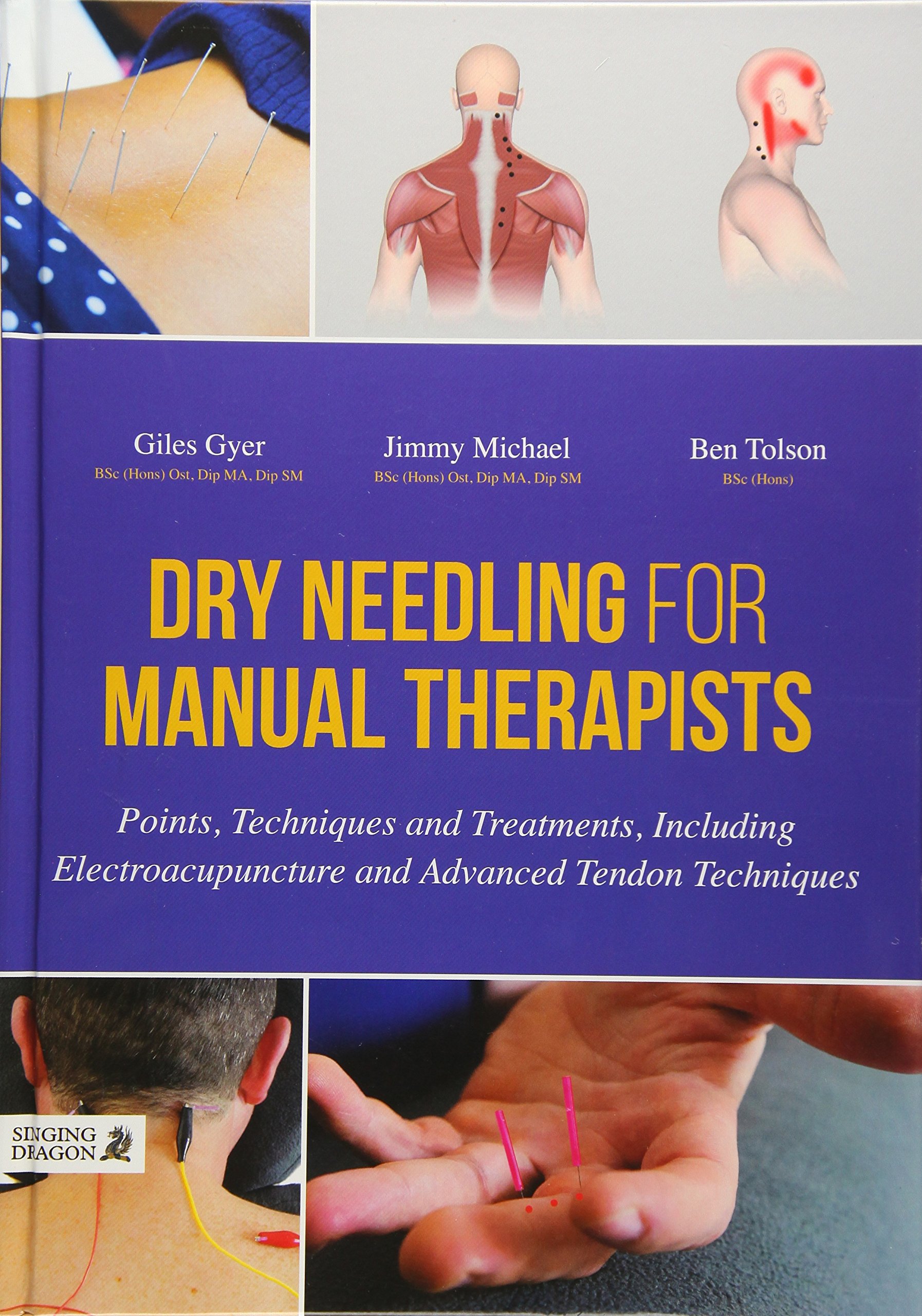 Dry Needling for Manual Therapists: Points, Techniques and Treatments,  Including Electroacupuncture and Advanced Tendon Techniques: Amazon.co.uk:  Jimmy ...