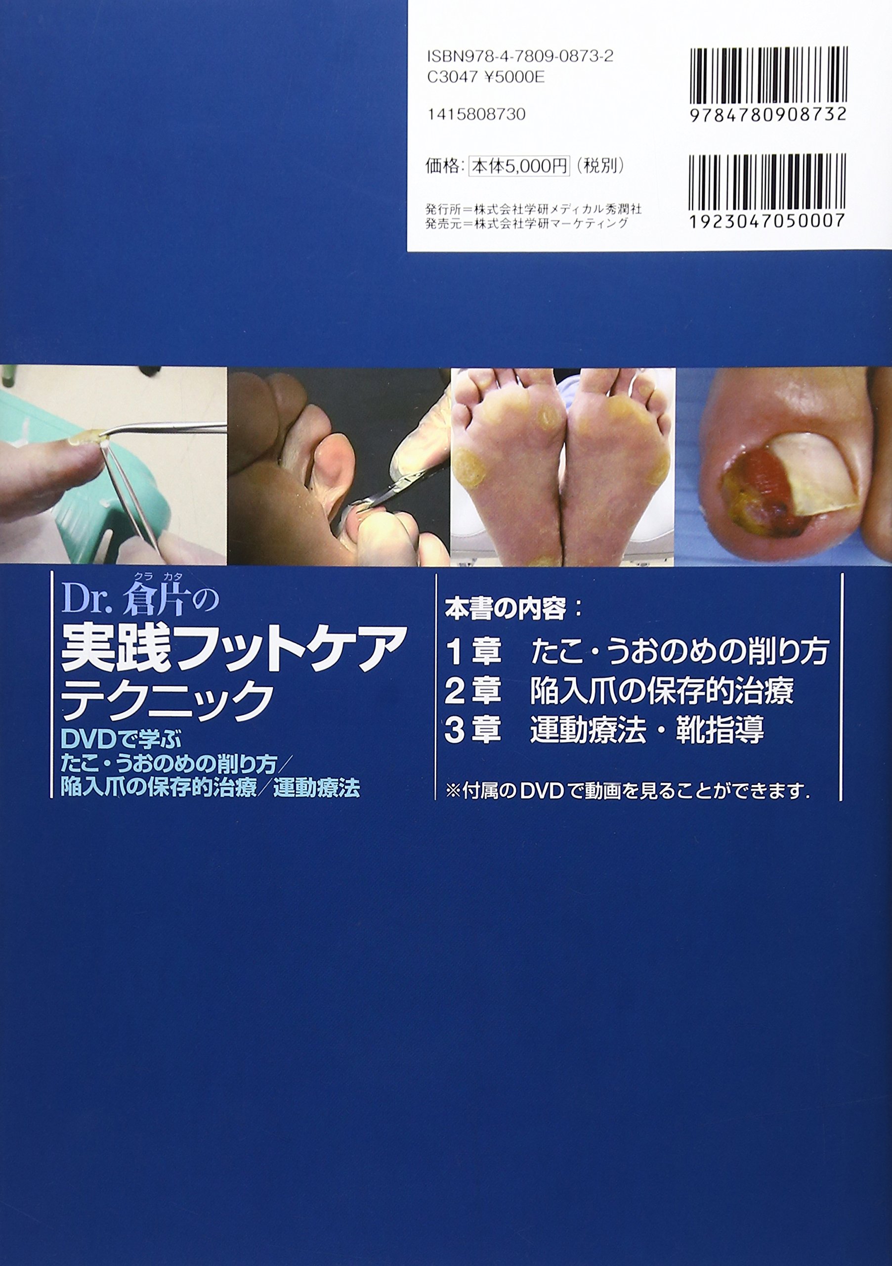 Dr 倉片の実践フットケアテクニック Dvdで学ぶ たこ うおのめ削り方 陥入爪の保存的治療 運動療法 倉片 長門 倉片 長門 本 通販 Amazon