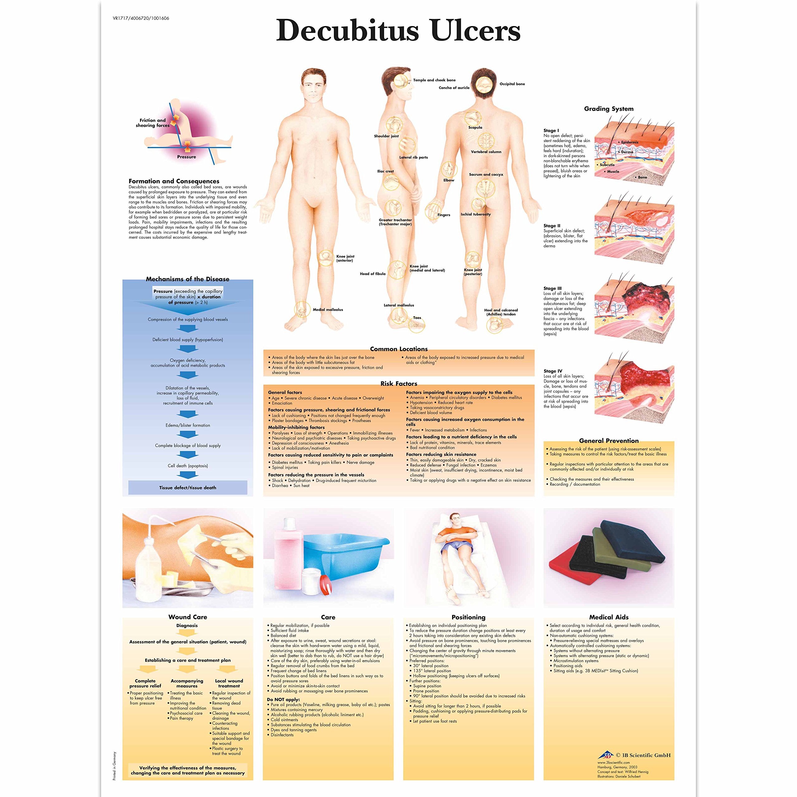 3B Scientific Human Anatomy - Decubitus Ulcers Chart, Paper Version