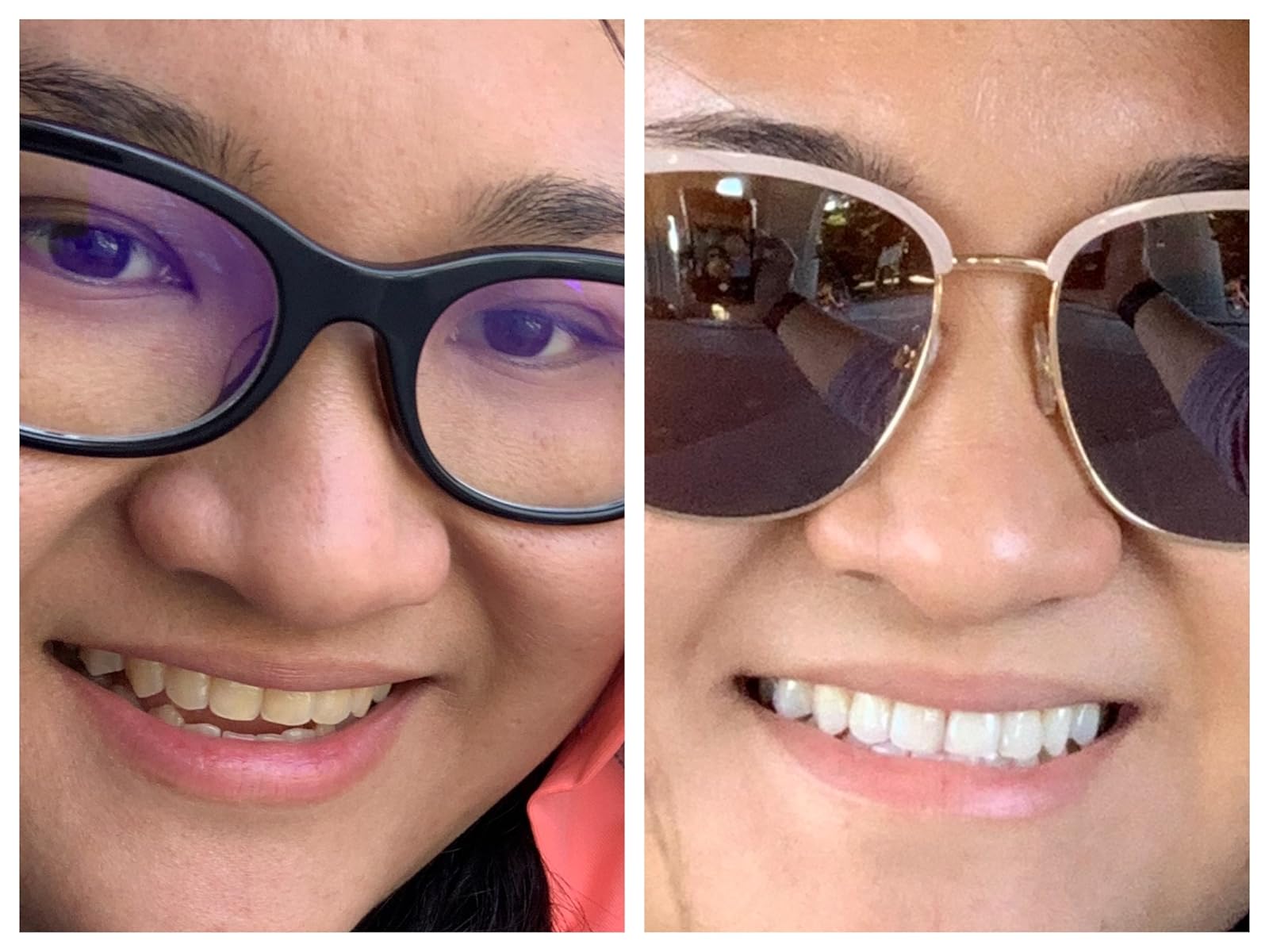 11 Best Crest Whitening Strips for Sensitive Teeth [99 Review]