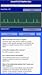ECG Rhythms Quiz