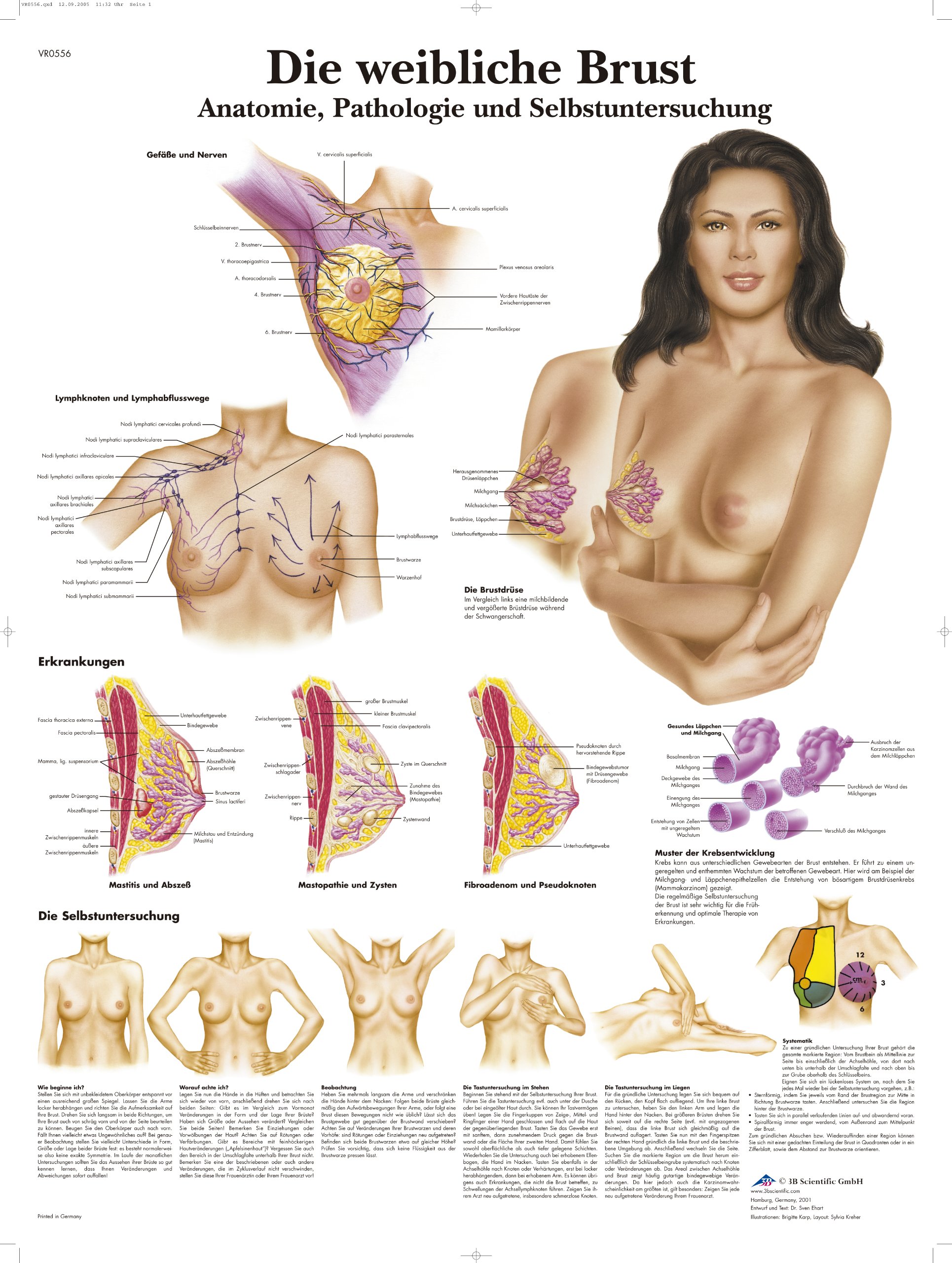 3B Scientific VR0556UU The Female Breast Anatomy Chart 1, Pathology and Self-Examination