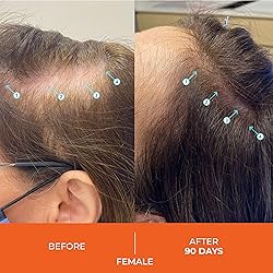 DS Laboratories Revita Shampoo - Hair Thickening