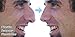 Plastic Surgery Simulator