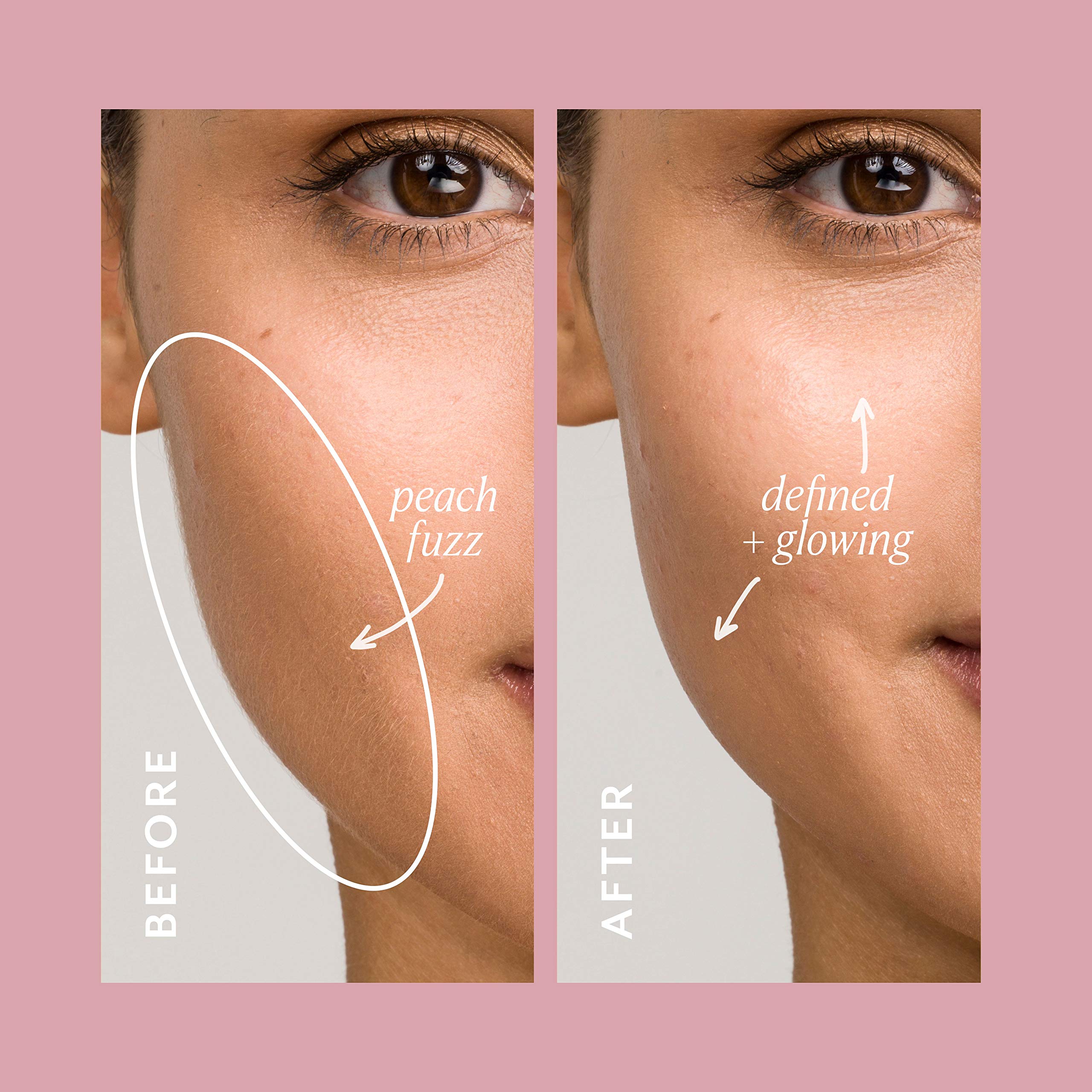 DERMAFLASH ONE Device, Exfoliating and Peach Fuzz Hair Removal, Sonic Dermaplaning Tool