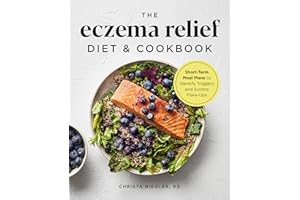The Eczema Relief Diet & Cookbook: Short-Term Meal Plans to Identify Triggers and Soothe Flare-Ups