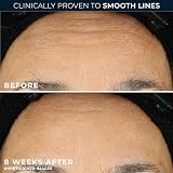 RoC Retinol Correxion Line Smoothing Night Serum Capsules 30 Count view 4