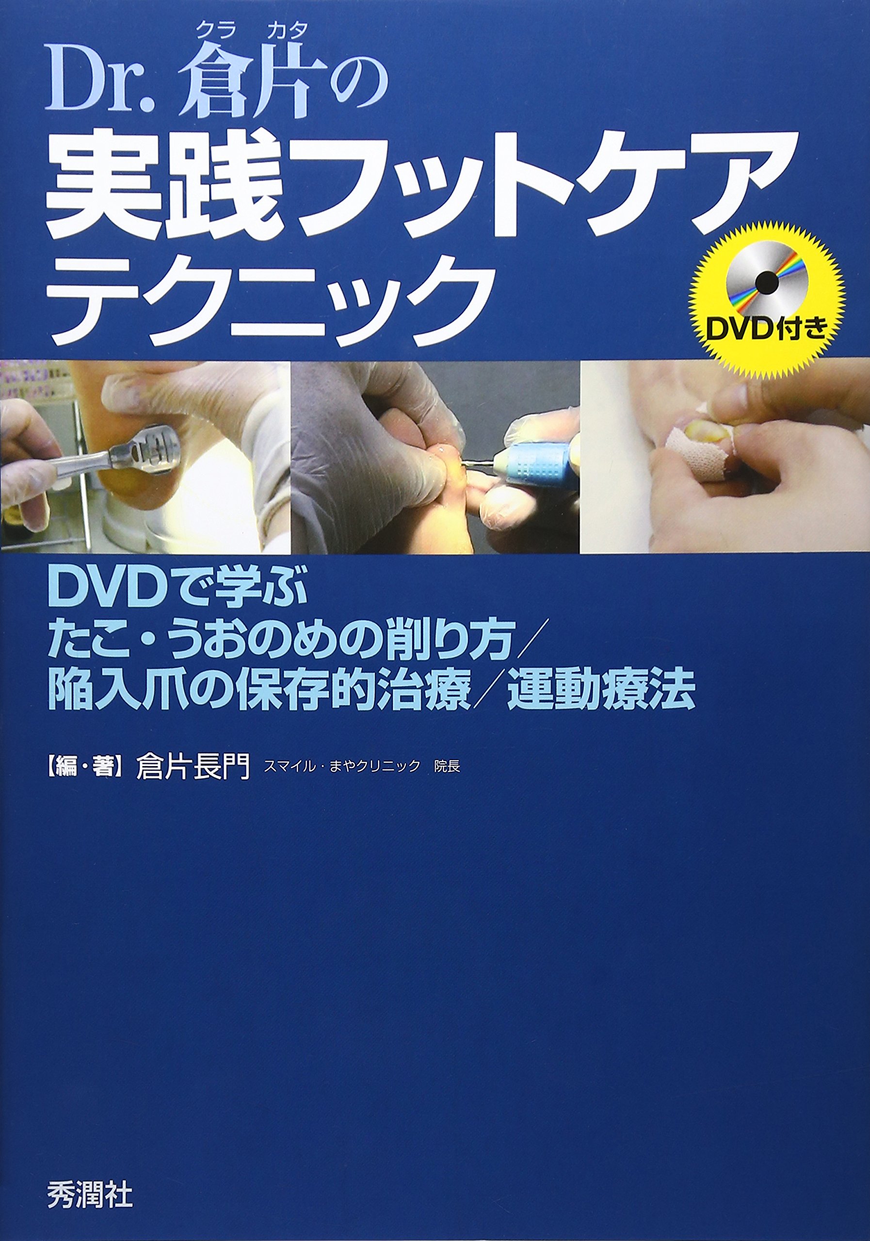 Dr 倉片の実践フットケアテクニック Dvdで学ぶ たこ うおのめ削り方 陥入爪の保存的治療 運動療法 倉片 長門 倉片 長門 本 通販 Amazon