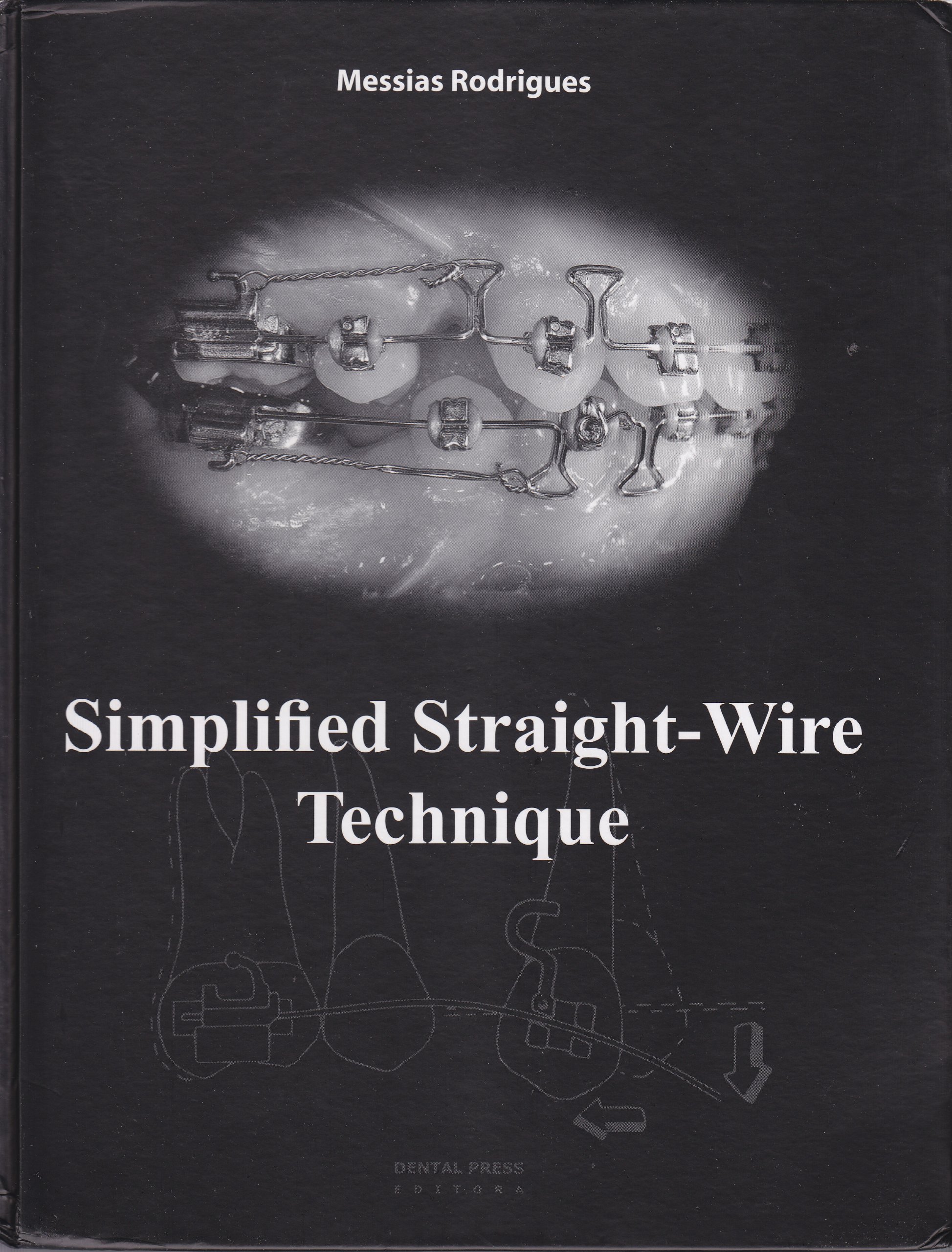 Simplified StraightWire Technique PDF Messias Rodrigues