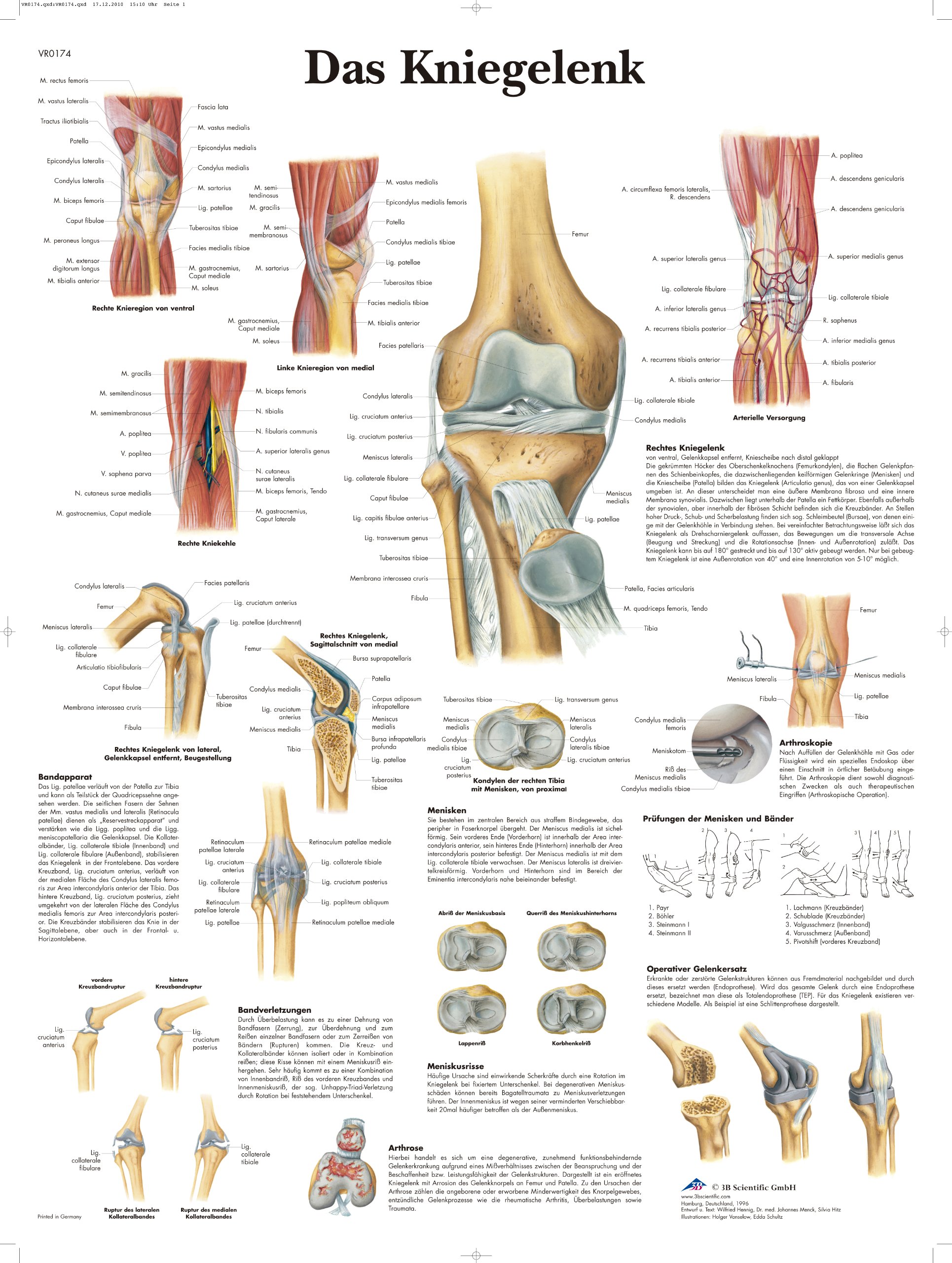3B Scientific 'Das Kniegelenk' Anatomical Chart (German Language)