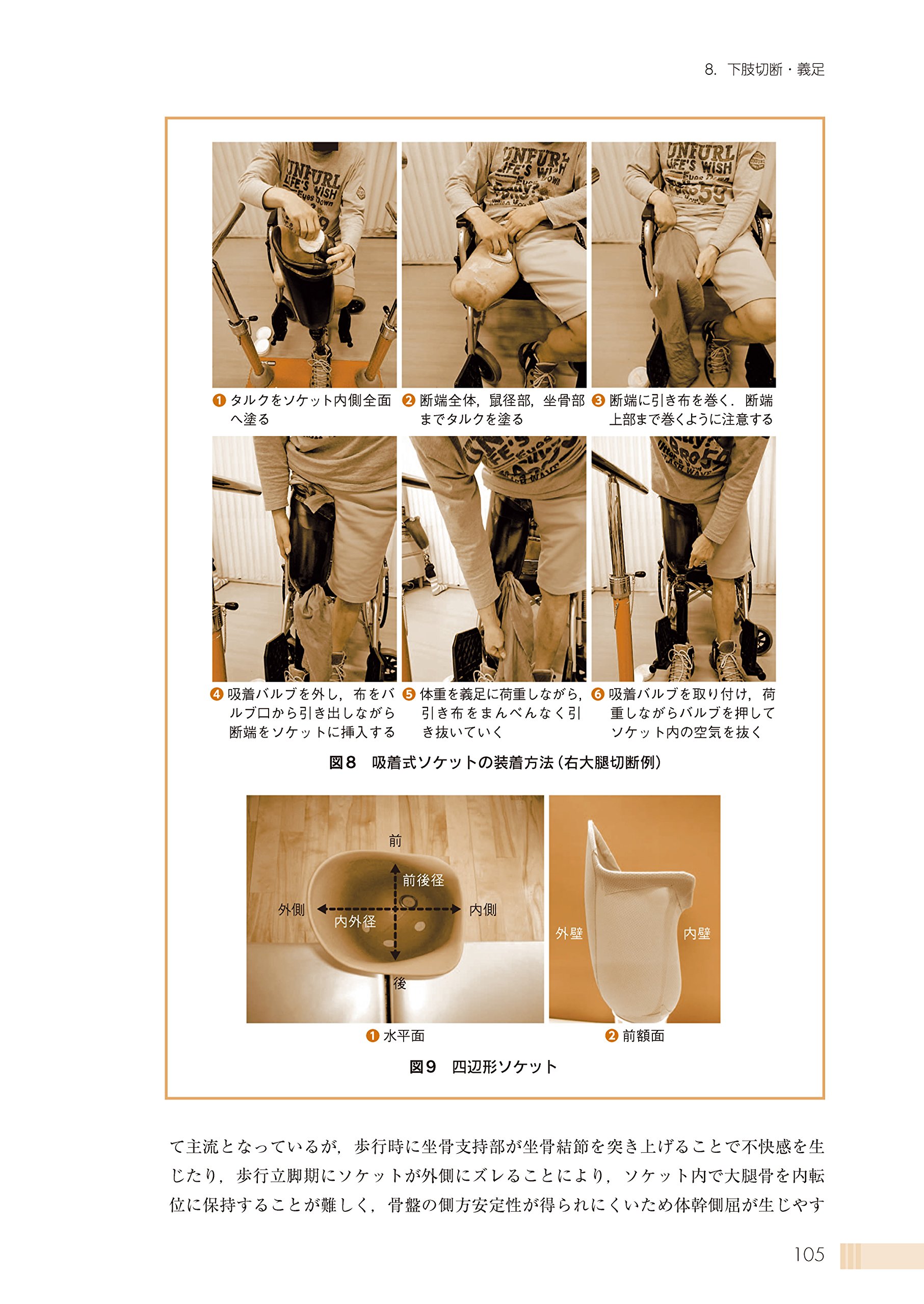 義肢装具と作業療法 評価から実践まで 大庭潤平 西村誠次 柴田八衣子 本 通販 Amazon