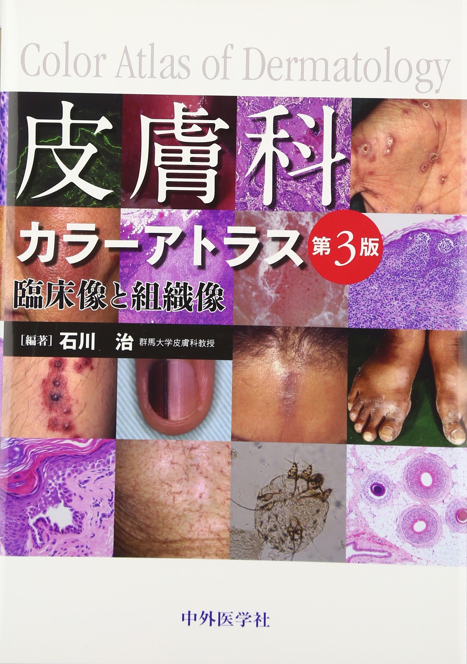 おすすめ 皮膚科カラーアトラス 臨床像と組織像 品 売り切れ必至 Www Iacymperu Org