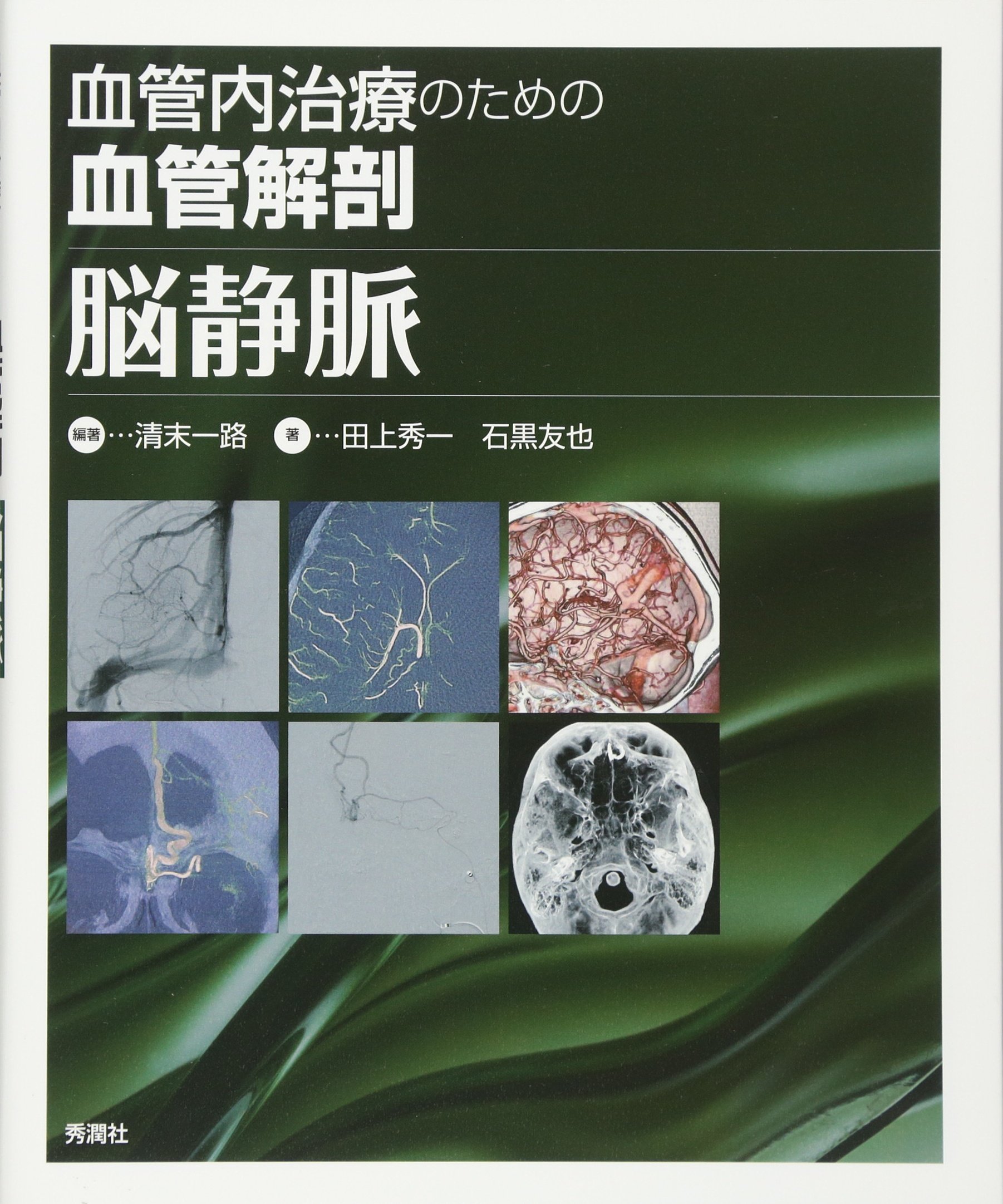 血管内治療のための血管解剖 脳静脈 清末一路 田上秀一 石黒友也 清末一路 本 通販 Amazon