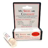My Spots Are ConSealed - Porcelain