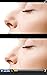 Plastic Surgery Simulator