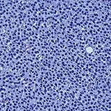 Rubin's Pathology Lippincott's Illustrated Q&A Review