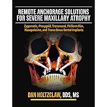 Amazon.com: Remote Anchorage Solutions for Severe Maxillary