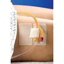 Amazon.com: MJ54453 - Mc Johnson Co Inc CATH-SECURE Multi-Purpose 
