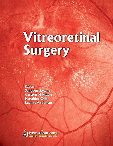Download Vitreoretinal Surgery (English Edition) PDF