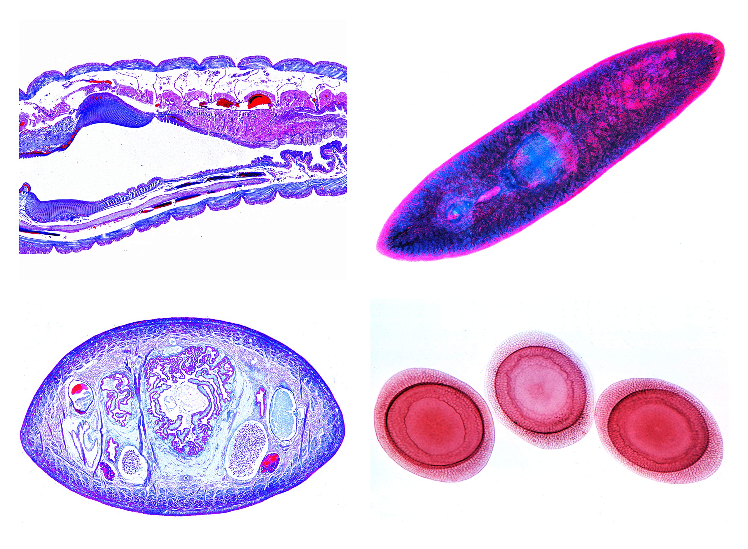 3B Scientific Biology Microscopy Microscopy Series Sponges and Hollow Animals (Coelenterata, Porifera)