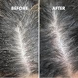 Umberto Giannini Scalp Serum 50ml Exfoliating Scalp Scrub - Vegan view 4