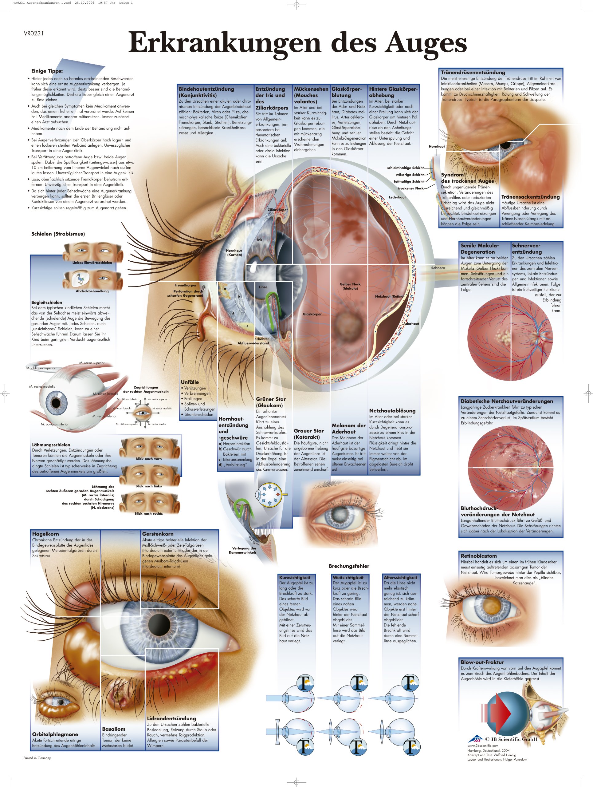 3B Scientific Lehtrafel - Eye Diseases, 1