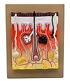 EISCO Human Skin Model, 300x Enlarged - with Hand