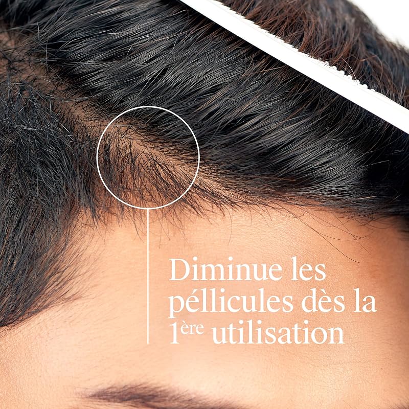 Shampoing T/Gel Fort Démangeaisons Sévères, flacon de 250 ml