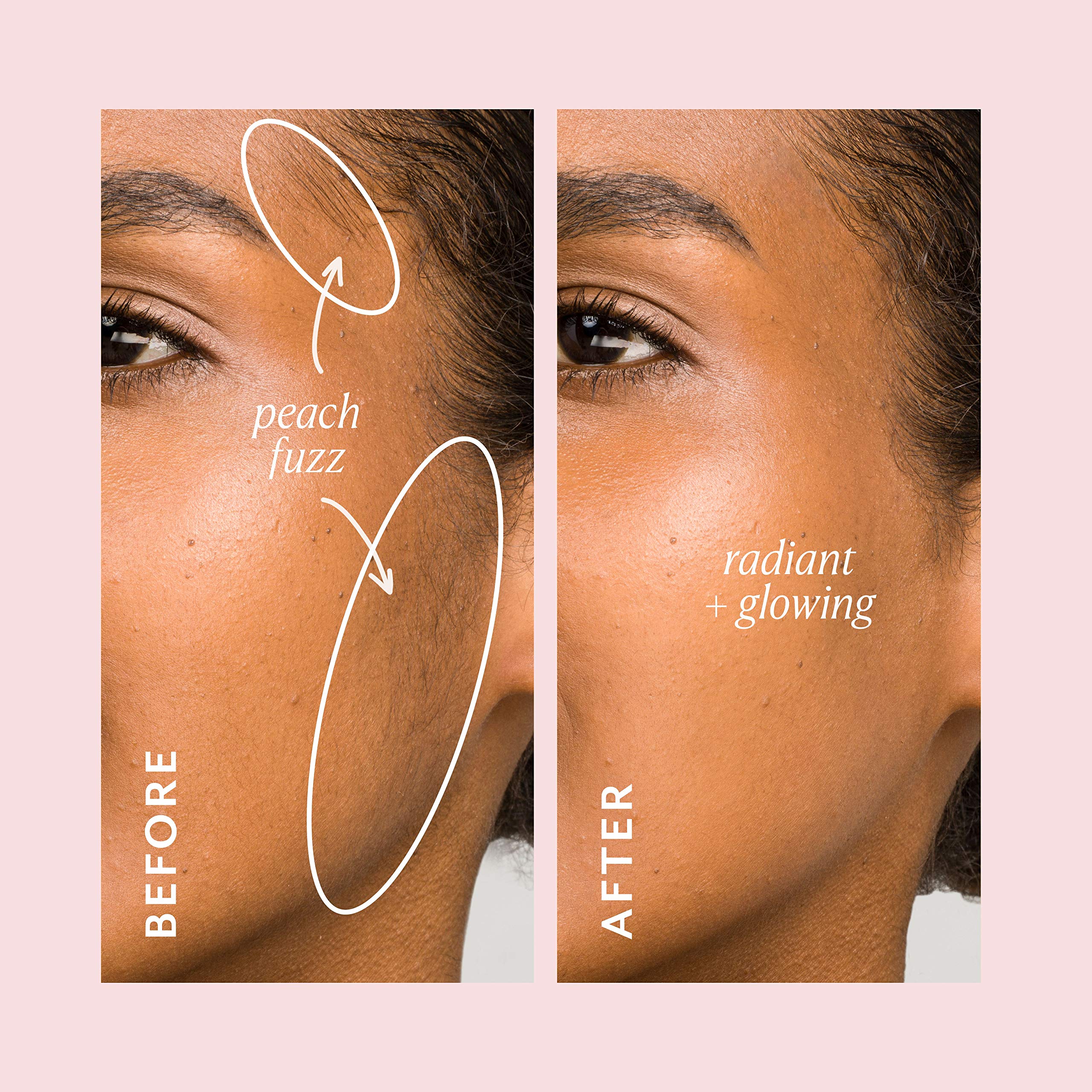 DERMAFLASH ONE Device, Exfoliating and Peach Fuzz Hair Removal, Sonic Dermaplaning Tool