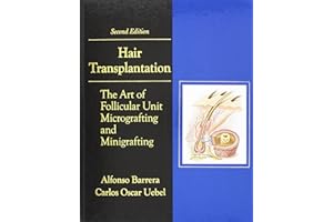 Hair Transplantation: The Art of Micrografting and Minigrafting