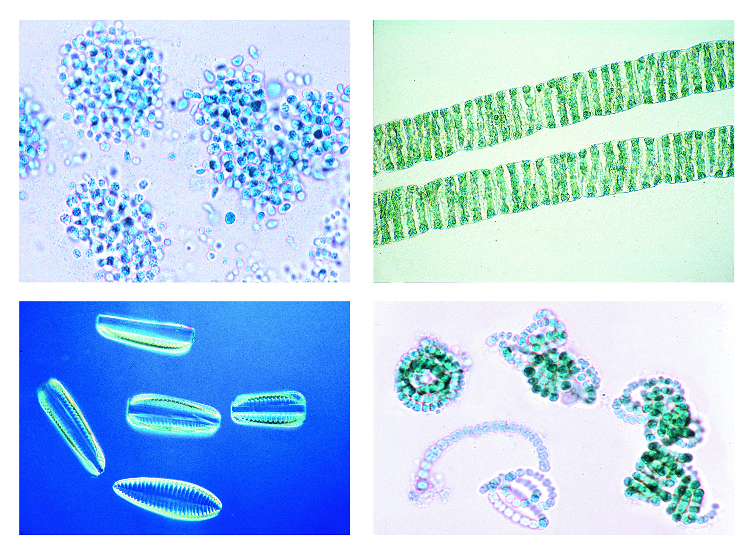 3B Scientific Biology Microscopy Micropräparate Series_ Environment I: Forest: Cause & Effects of Forest Damage