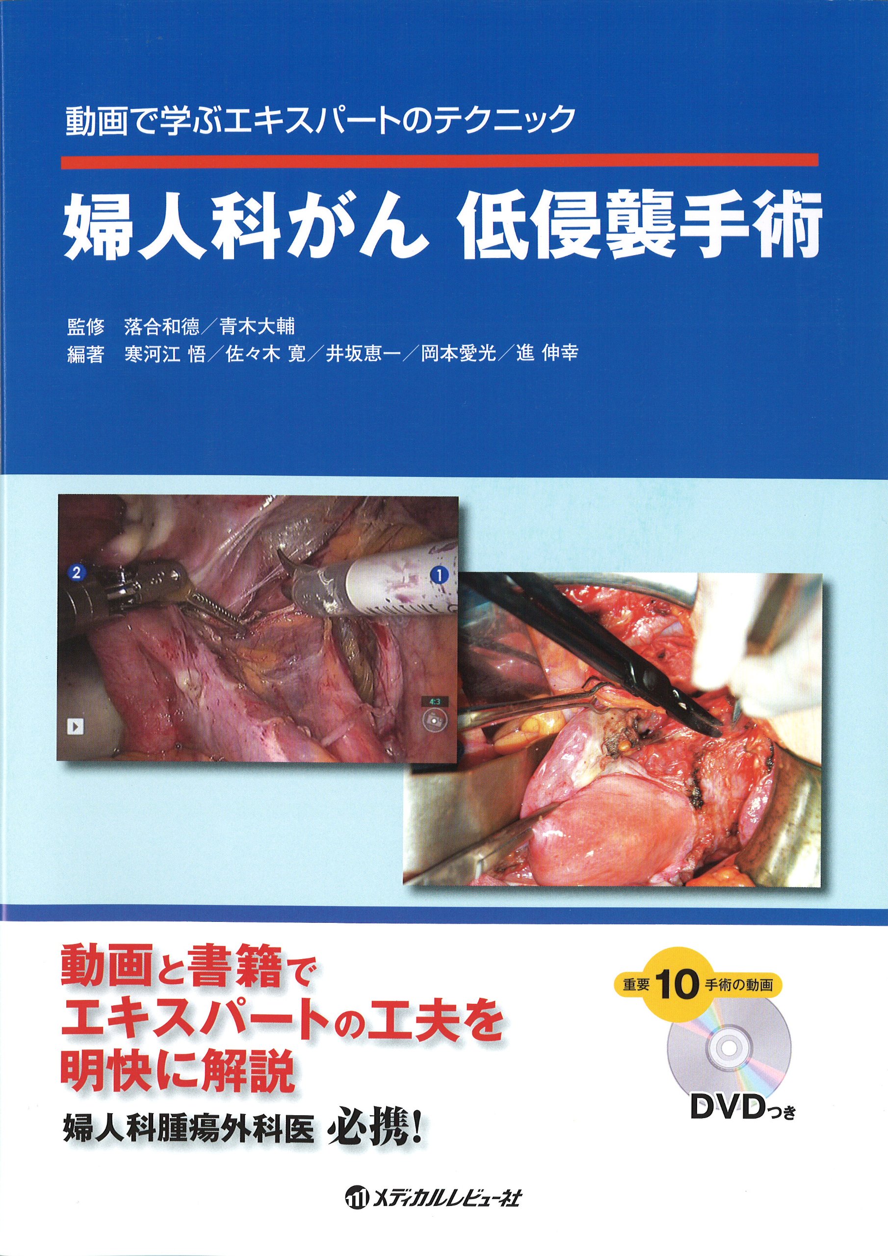 婦人科がん低侵襲手術 動画で学ぶエキスパートのテクニック 落合和徳 青木大輔 本 通販 Amazon