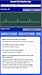 ECG Rhythms Quiz