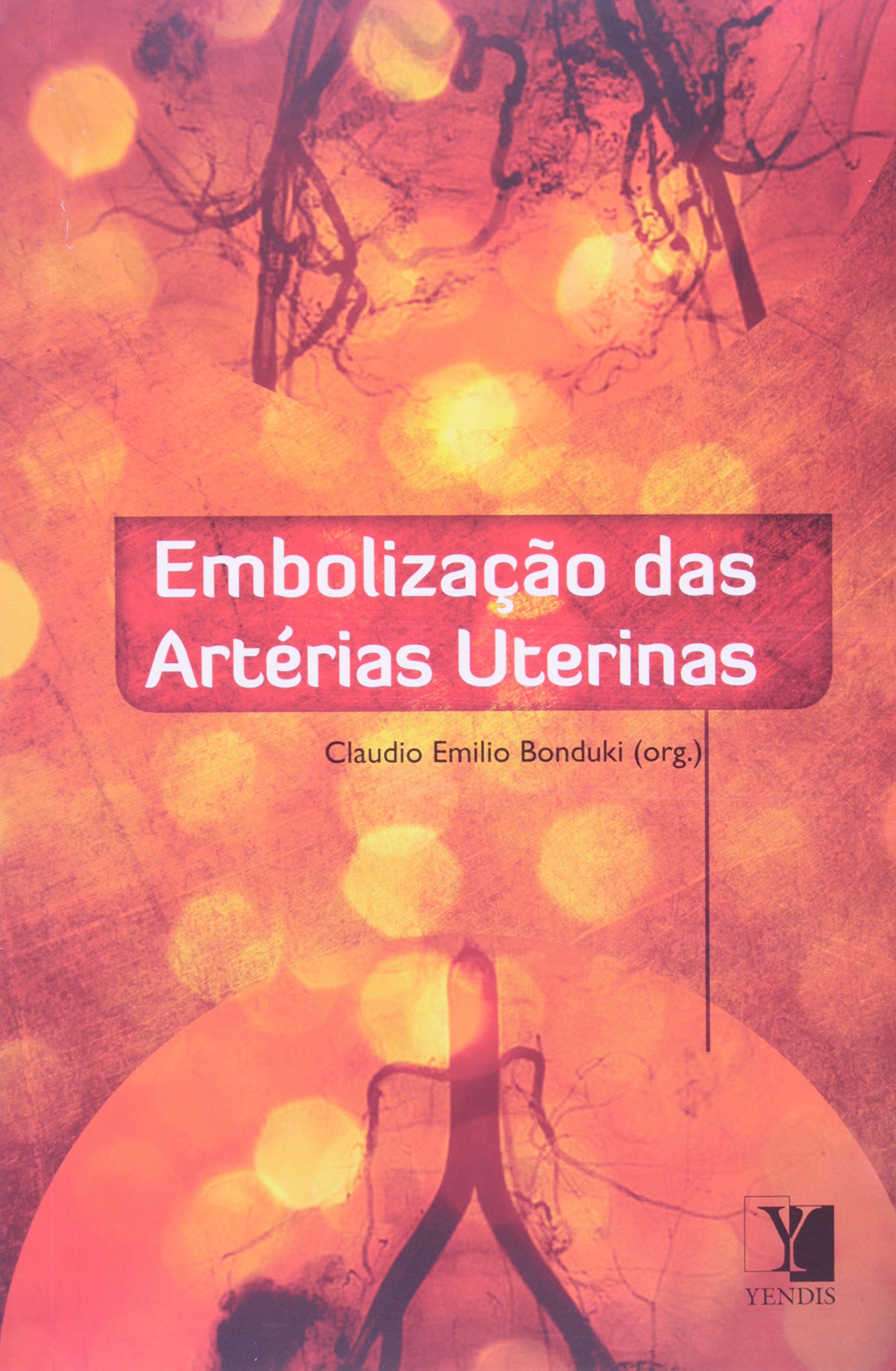 Embolização das Artérias Uterinas PDF Vários Autores