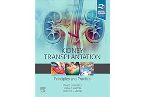 Kidney Transplantation - Principles and Practice: Expert Consult - Online and Print