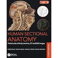 A color atlas of sectional anatomy医学洋書大型 A color atlas of sectional anatomy医学洋書大型 - メルカリ