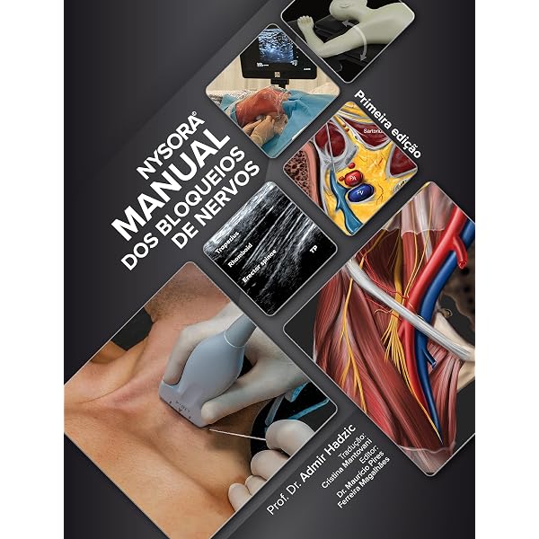 NYSORA Nerve Block Manual: First Edition (Regional Anesthesia Book
