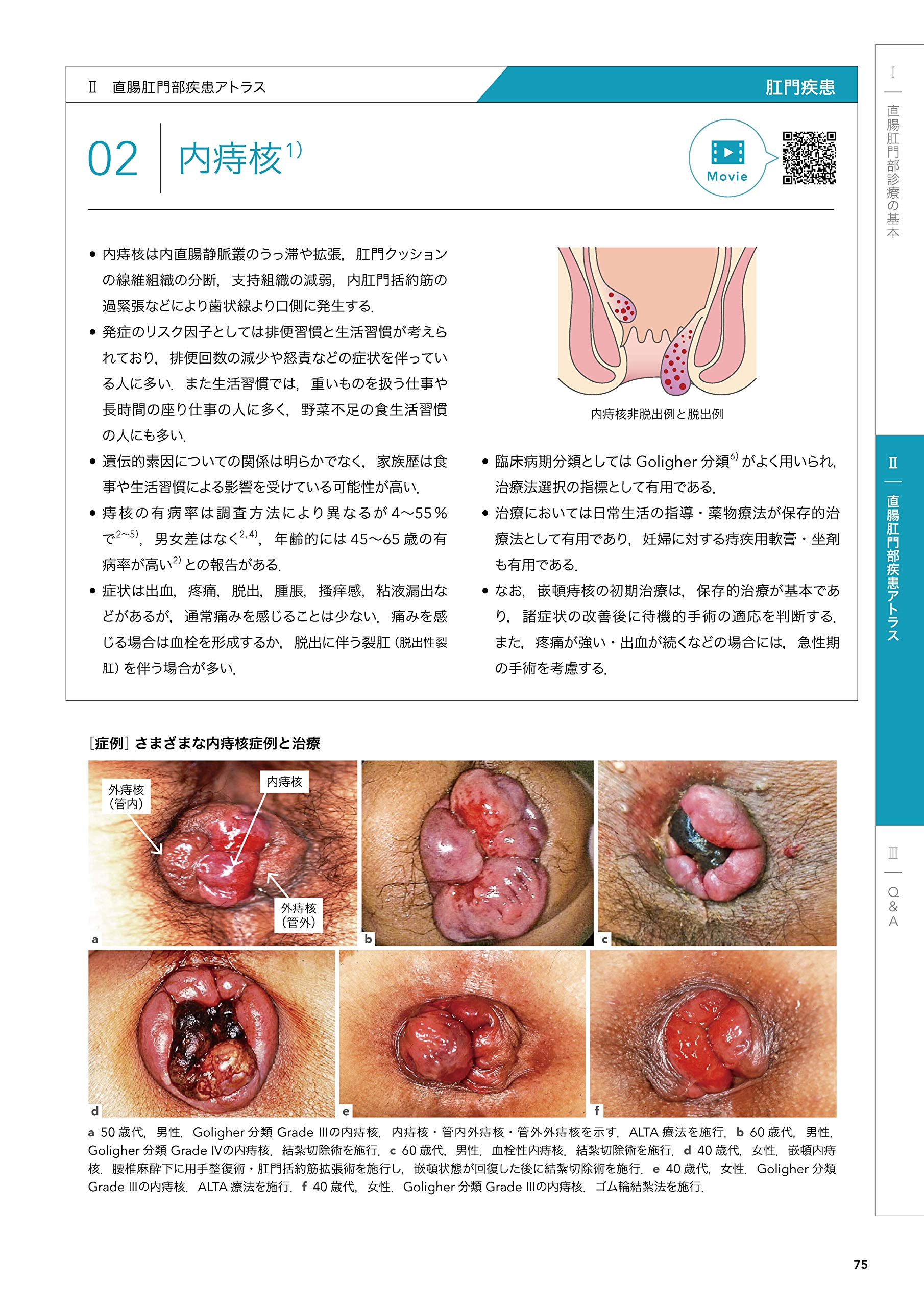 おしりの病気 アトラス Web動画付 Amazon Com Books