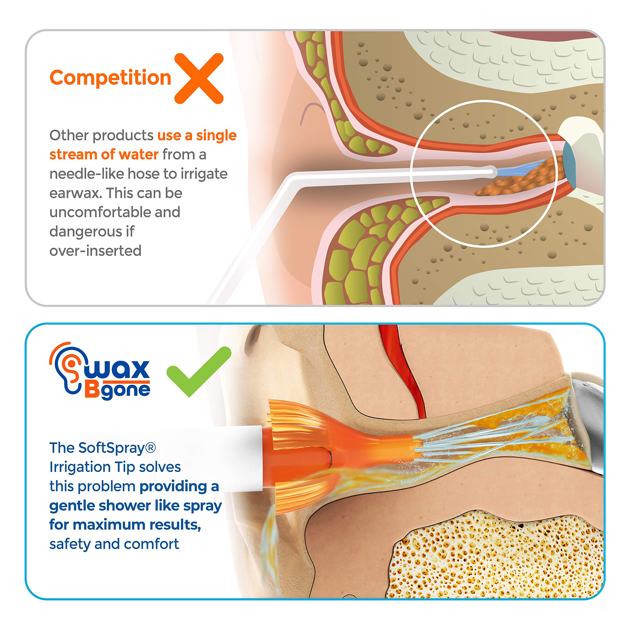 waxBgone Earwax Removal Kit - Fast, Gentle, and Effective Ear Wax Removal Kit – Dissolve and Remove Earwax at Home - Includes Earwax Softening Drops, 10 SoftSpray Reusable Irrigation Tips, Otoscope
