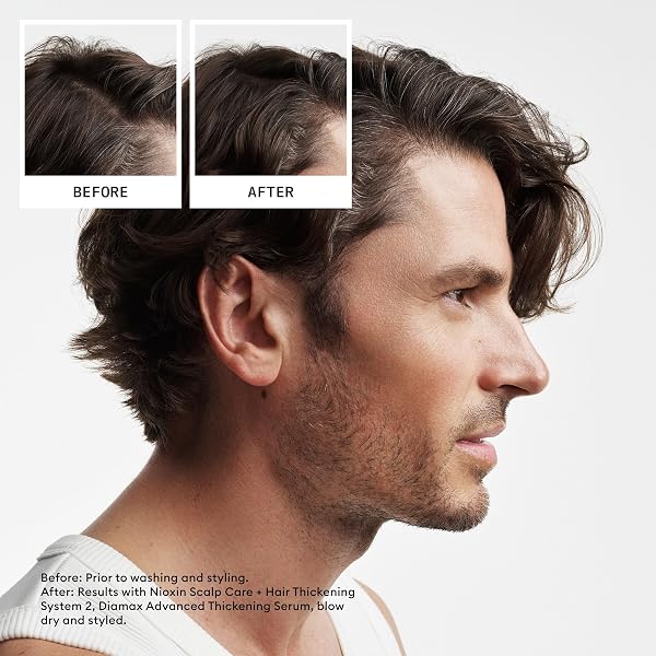 NIOXIN SYSTEM 2 | SCALP CARE | LEAVE-IN TREATMENT | FOR NATURAL HAIR