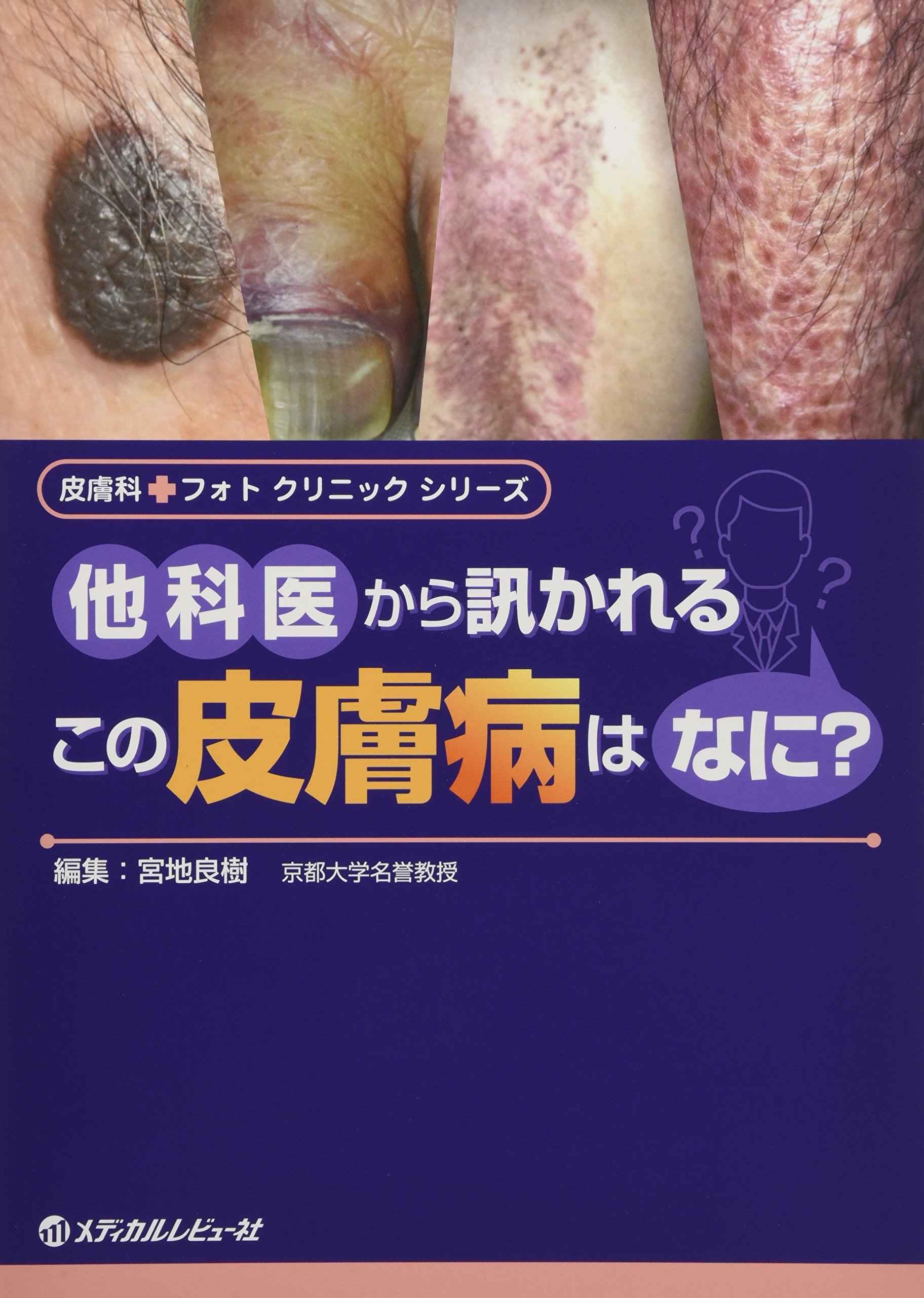 他科医から訊かれるこの皮膚病はなに 皮膚科フォトクリニックシリーズ 宮地 良樹 本 通販 Amazon