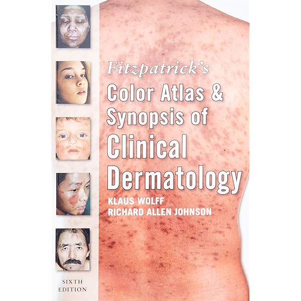 Lookingbill and Marks' Principles of Dermatology (PRINCIPLES OF