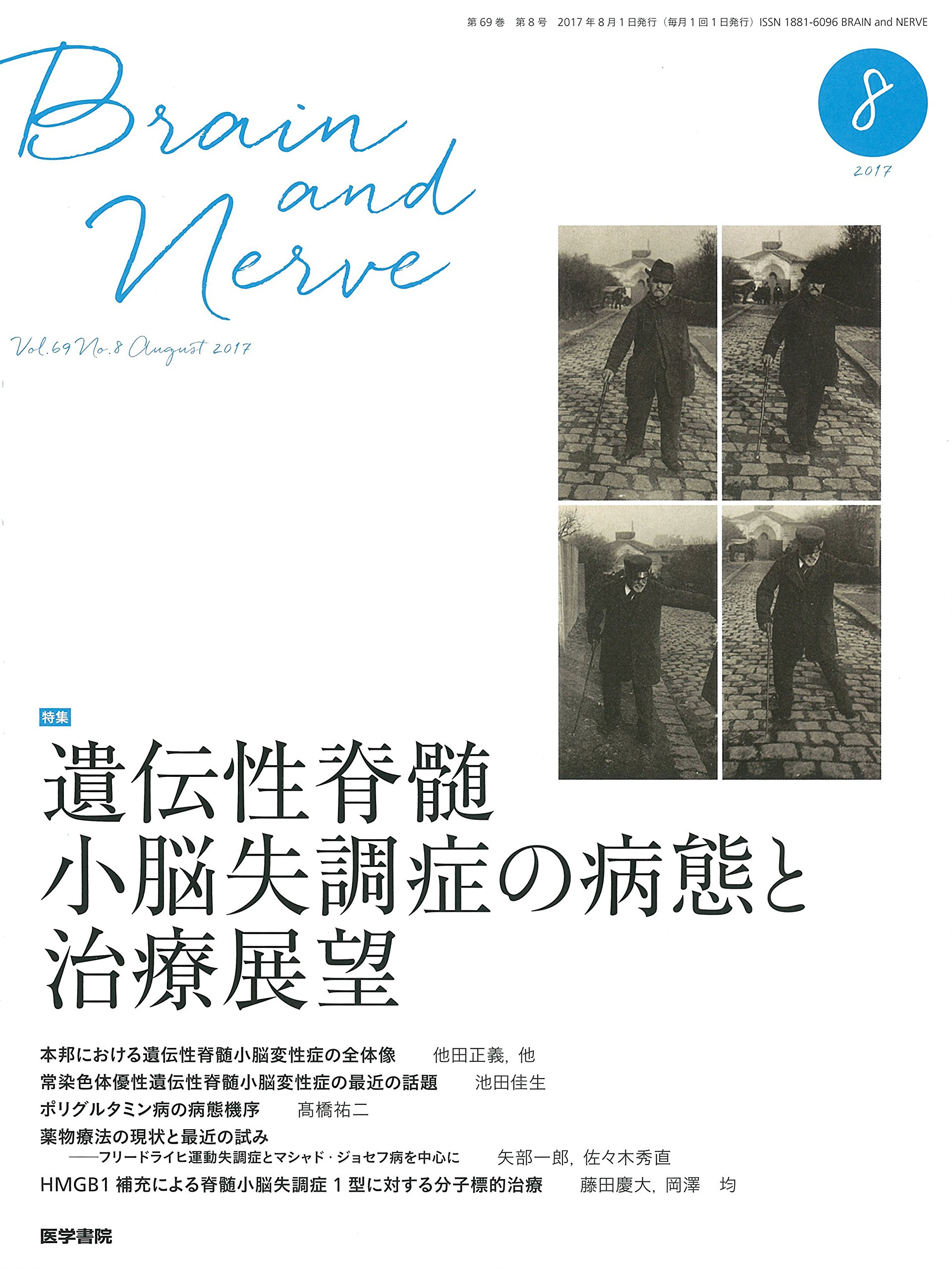 Brain And Nerve 神経研究の進歩 17年 8月号 特集 遺伝性脊髄小脳失調症の病態と治療展望 本 通販 Amazon